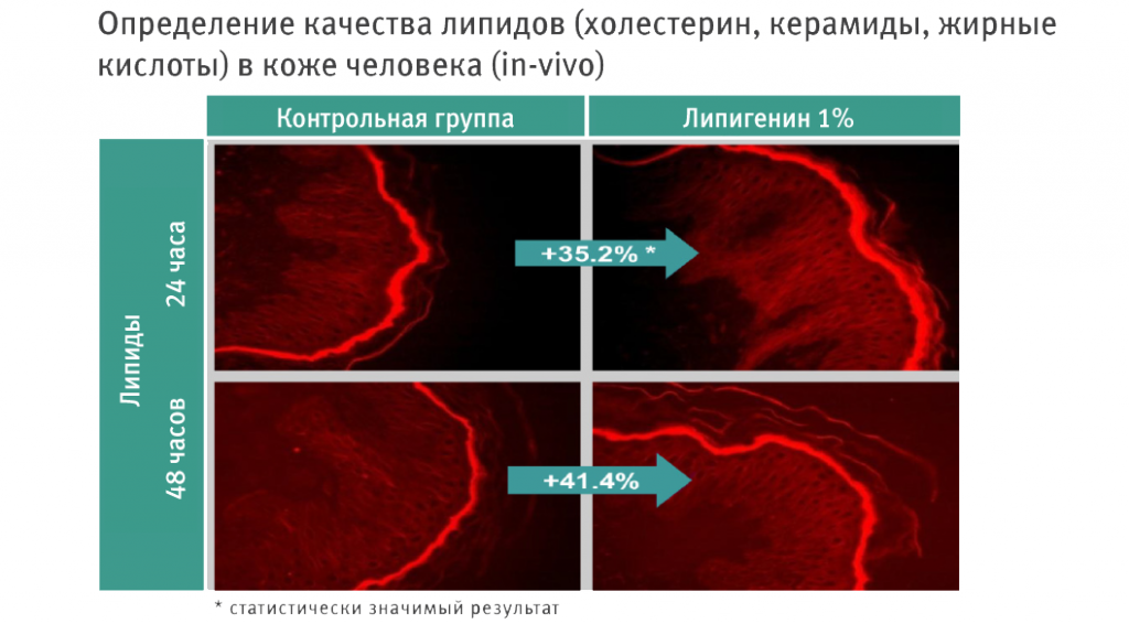 ProBright-Липигенин- copy.png